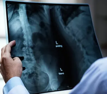 Ilustrasi perkhidmatan pengimejan x-ray
